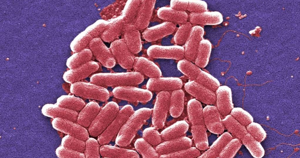 Alertan-en-EU-por-brote-de-E.-coli-ligado-a-frutos-rojos-congelados-GreenWise