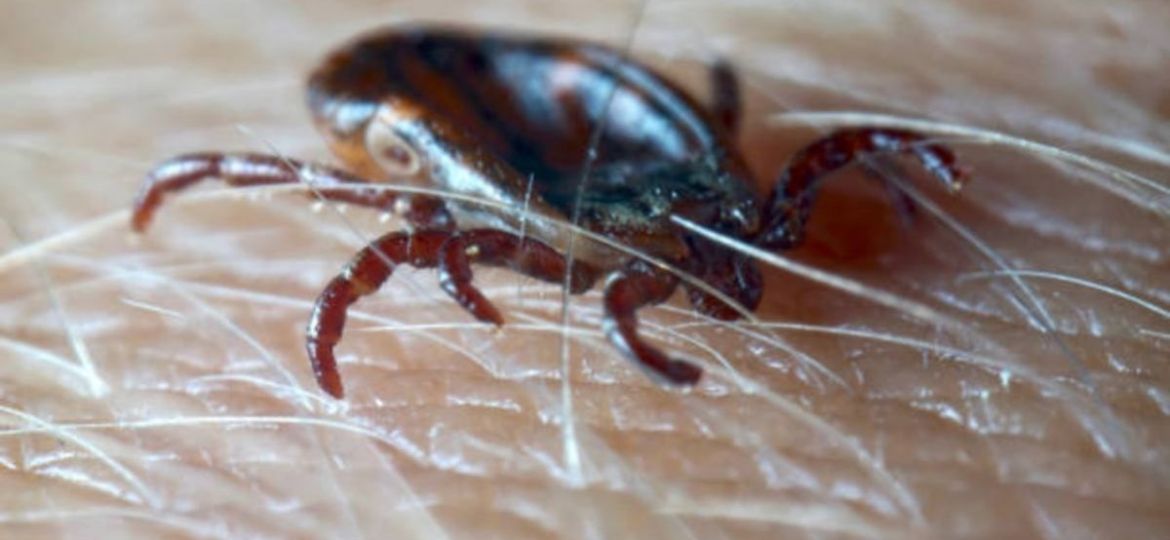 Confirman-en-Nueva-York-el-primer-caso-del-virus-Bourbon-transmitido-por-garrapatas