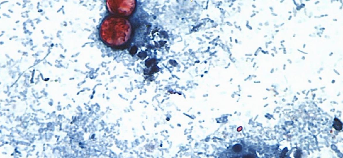 EU-reporta-dos-muertes-por-ciclosporiasis-en-Michigan-durante-brote-intestinal