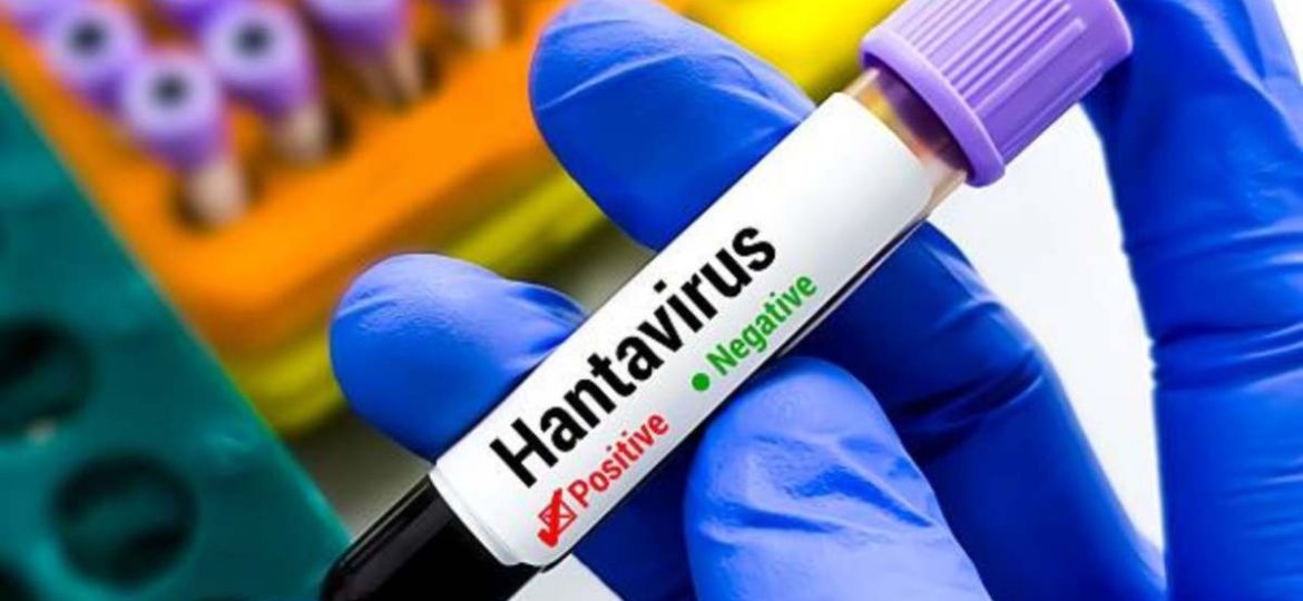 Turista-da-positivo-a-hantavirus-Andes-tras-viajar-por-Francia-y-permanece-aislado-en-Espana